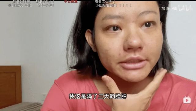 29岁女博主患上尿毒症这个坏习惯害了我医生劝告这种病越来越多4种