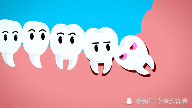 最疼莫过拔智齿唐山一大姐拔智生拉硬拽一小时医生都忍不住笑了