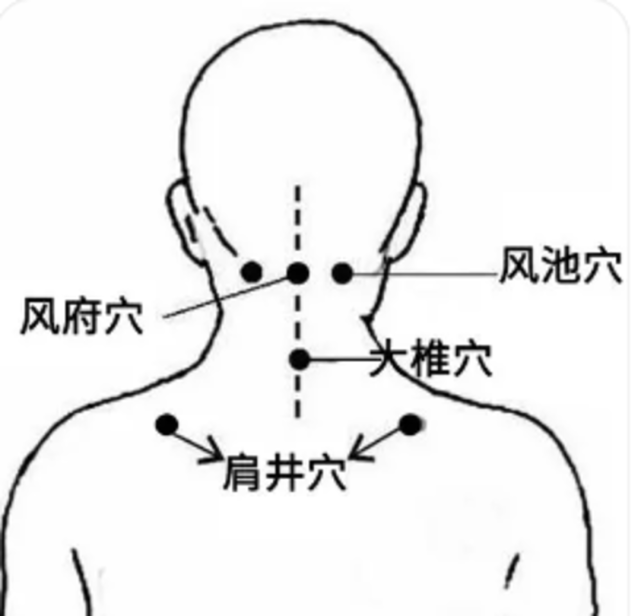 寒冷易诱发颈椎病.