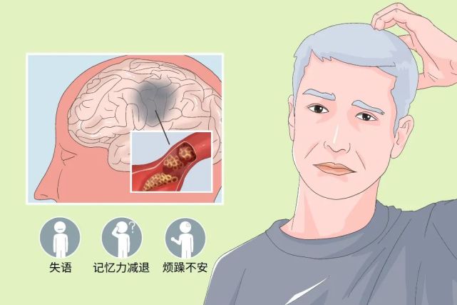 经颅磁刺激对轻度认知功能障碍的研究