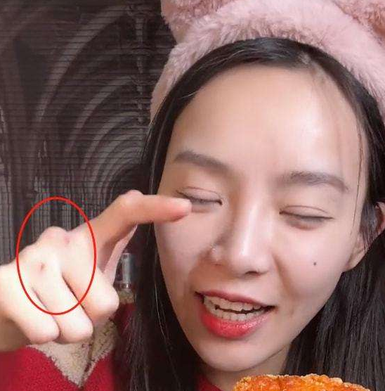 网红小贝近况憔悴呈现病态,手指有明显催吐痕迹,直怼网友扬言报警