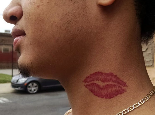 何翔医生科普小课堂——喜欢在男朋友脖子上"种草莓"?这样其实有危险!