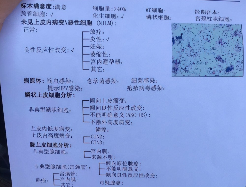 目前要想確診宮頸癌的話,一般是要先查tct ,hpv,如果tct ,hpv有異常了