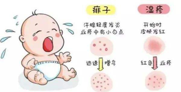 嬰兒溼疹如何處理