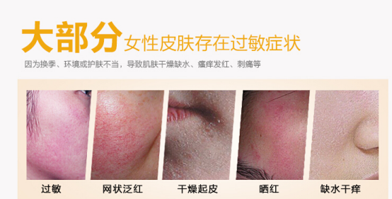 敏感肌的表现|护肤|化妆品|敏感肌|皮肤|肌肤|角质层