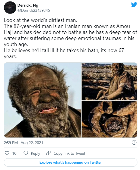 全世界最脏70年没洗澡检测惊揭免疫系统超强大消息传出后引发国际关注