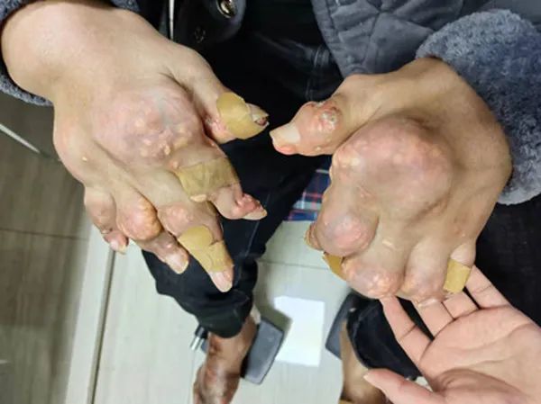 疼风 腾讯网