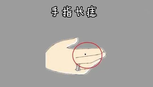 右手食指有痣的人有富贵命吗男女说法各有不同