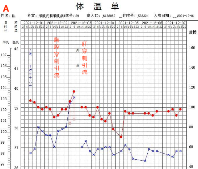 12月5日患者体温恢复正常(图4a).