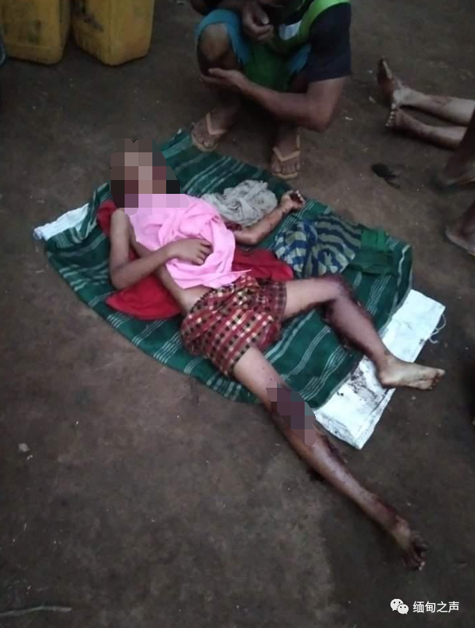 缅甸一名孕妇家门口被人埋雷，孕妇当场身亡，6岁男童伤势严重义乌哪里学英语比较好