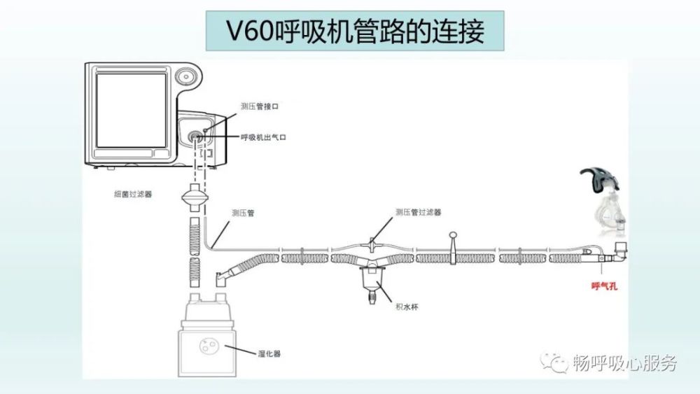 pptv60无创呼吸机的使用