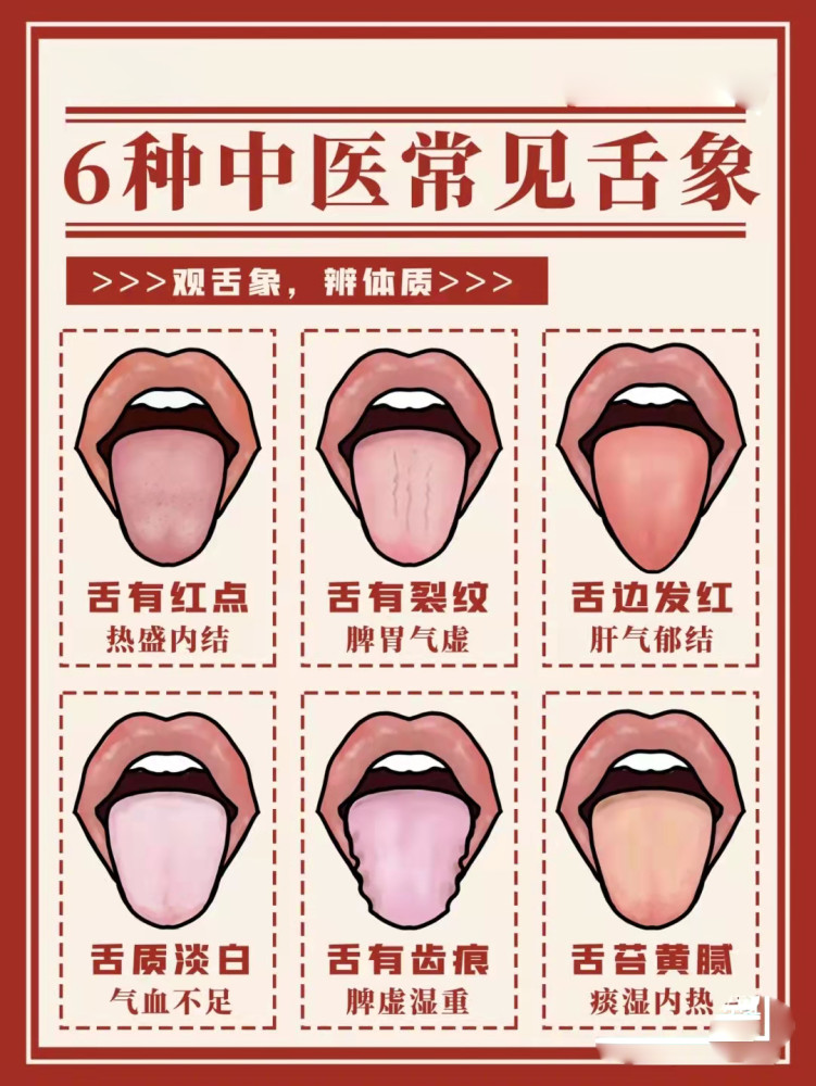 從舌苔看健康跟中醫學舌診這7種要注意