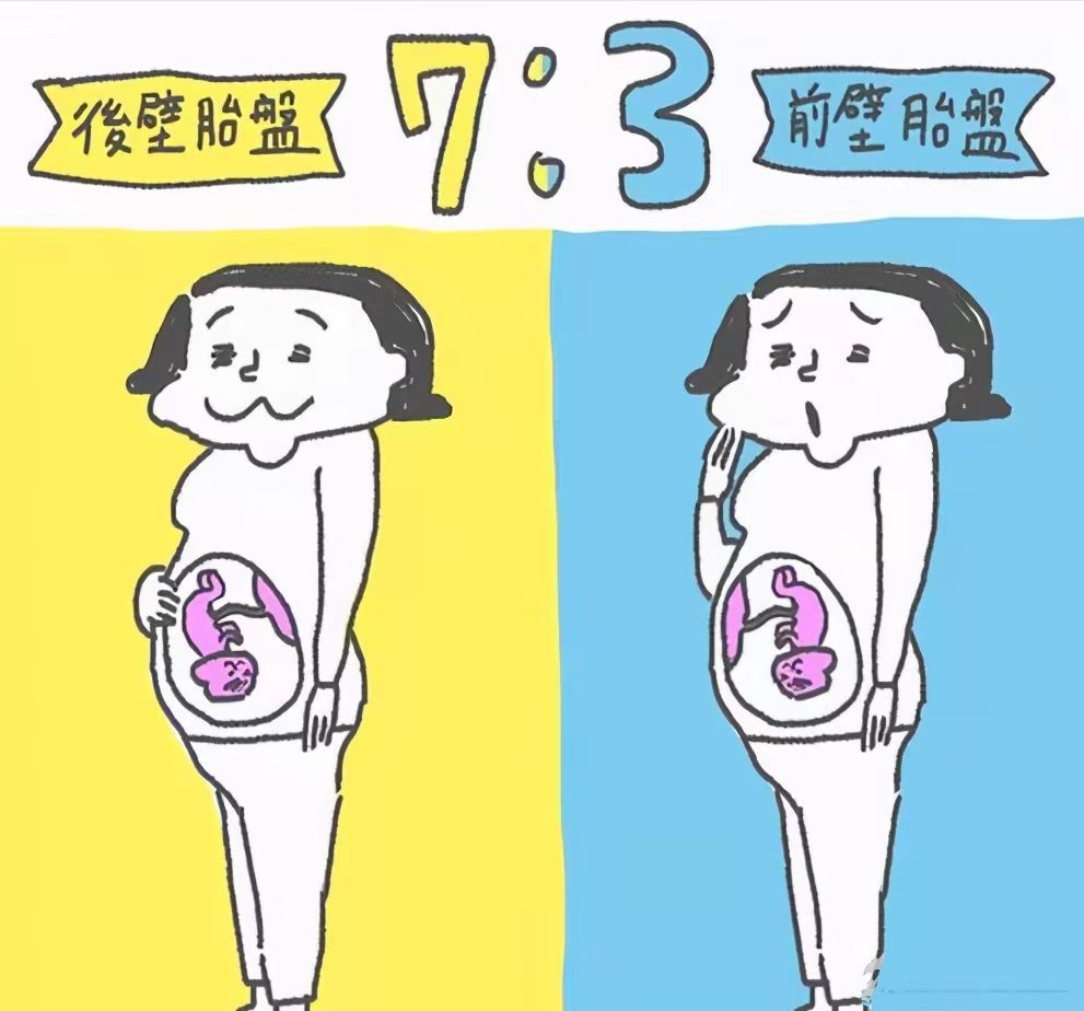 胎盘前壁的生男孩,胎盘后壁的生女孩?真准吗?