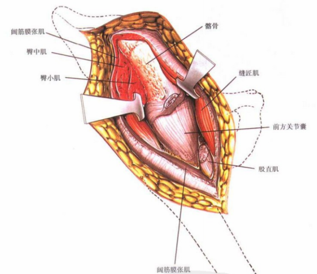 【骨科小技巧】髖關節前側入路!