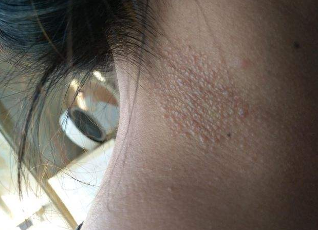 身边这4种女人,多半感染hpv了,明眼人一眼能看出,要拒绝