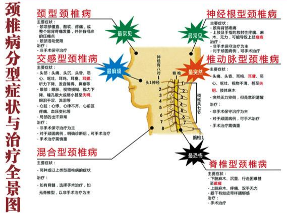 週三主任查房手記蹊蹺的背痛因在頸椎