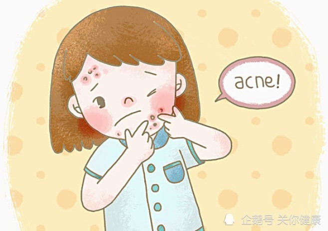 喝牛奶会促进痤疮的生长这是谣言还是科学研究的结论