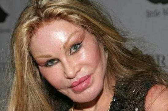 她整容成猫女爱情没挽留下反而断送自己的美貌如今怎样了