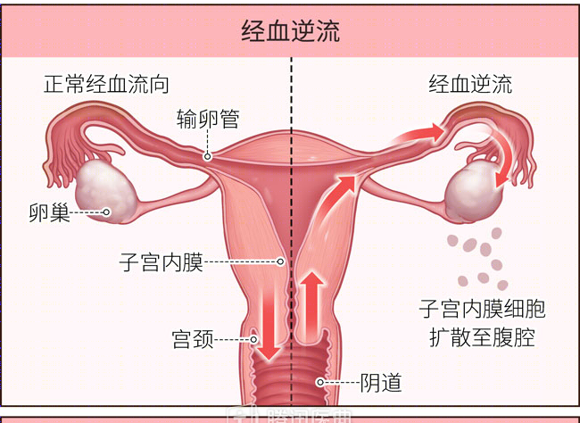 经血示范图片