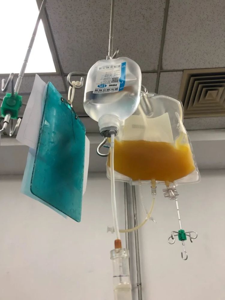 袋子里的血小板像一袋三黄鸡油看着就大补