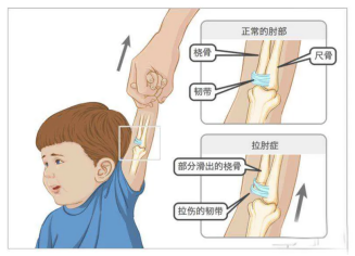 发怒可以气掉下巴脱臼了怎么办