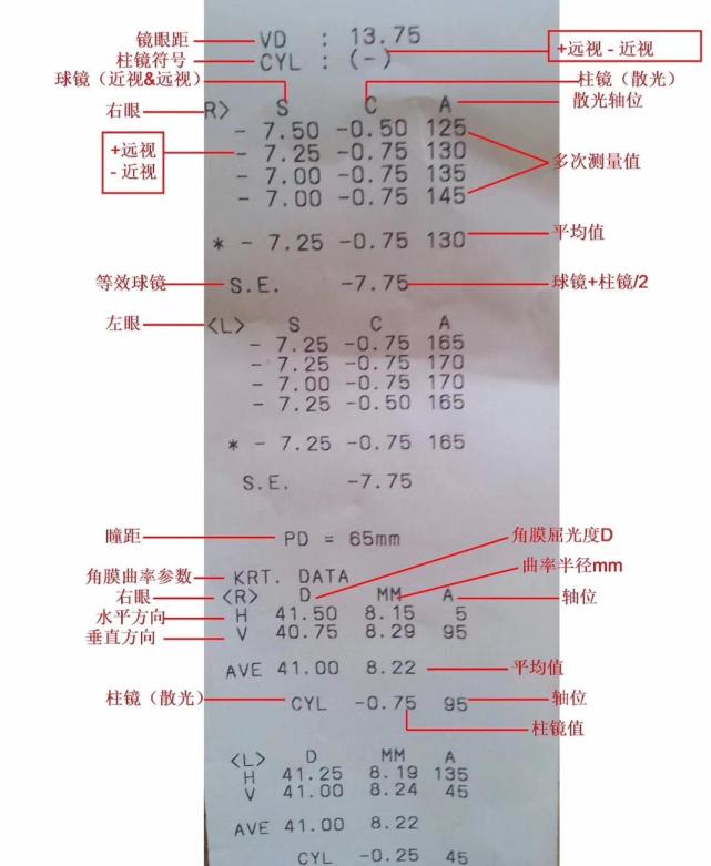 视力检查数据怎么看近视程度是否散光对照表来了快关注