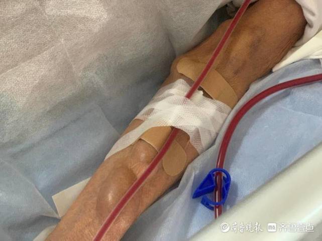 肾透析患者的"忙年":他们透析着自己,也透视着生命