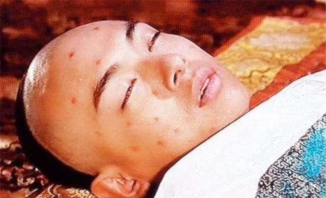 同治皇帝仅十九岁就病死他真是因为寻花问柳而染上不治之症的吗