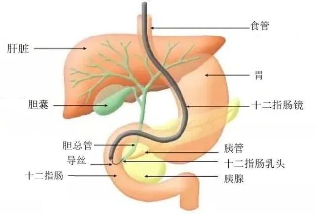 胆管在人体的什么位置图片