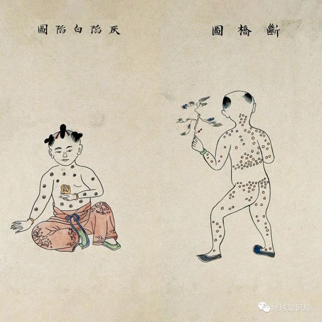 这终归只是一种充满不确定性的预防手段,得了天花的患儿即使痊愈了也