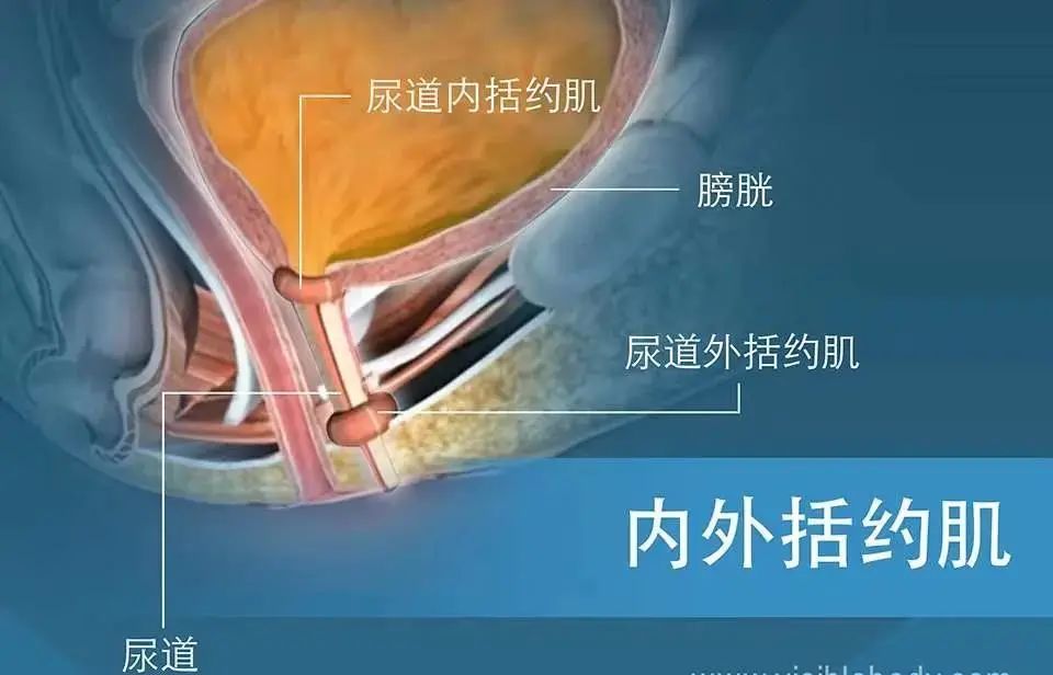 前列腺癌根治術後尿失禁了怎麼辦上海國際醫學中心今年首例人工尿道