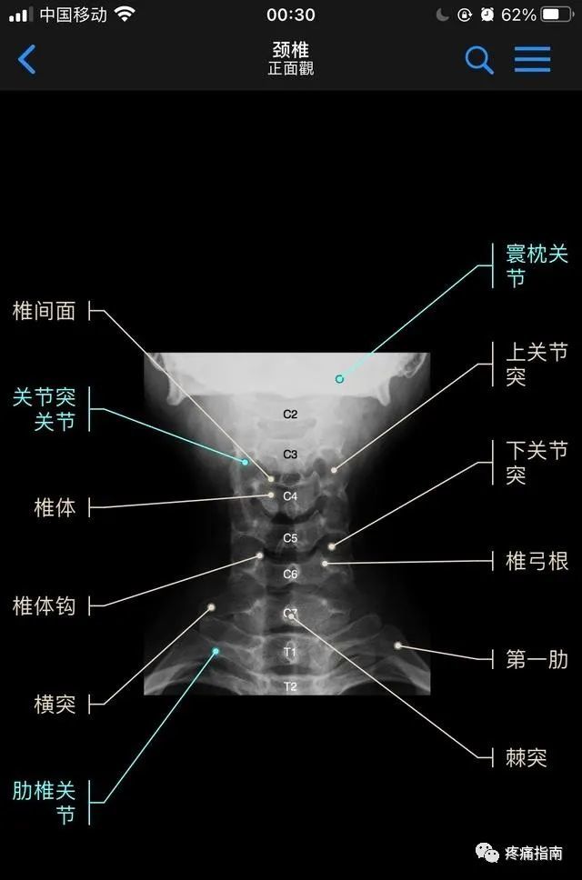 脊柱dr影像基础