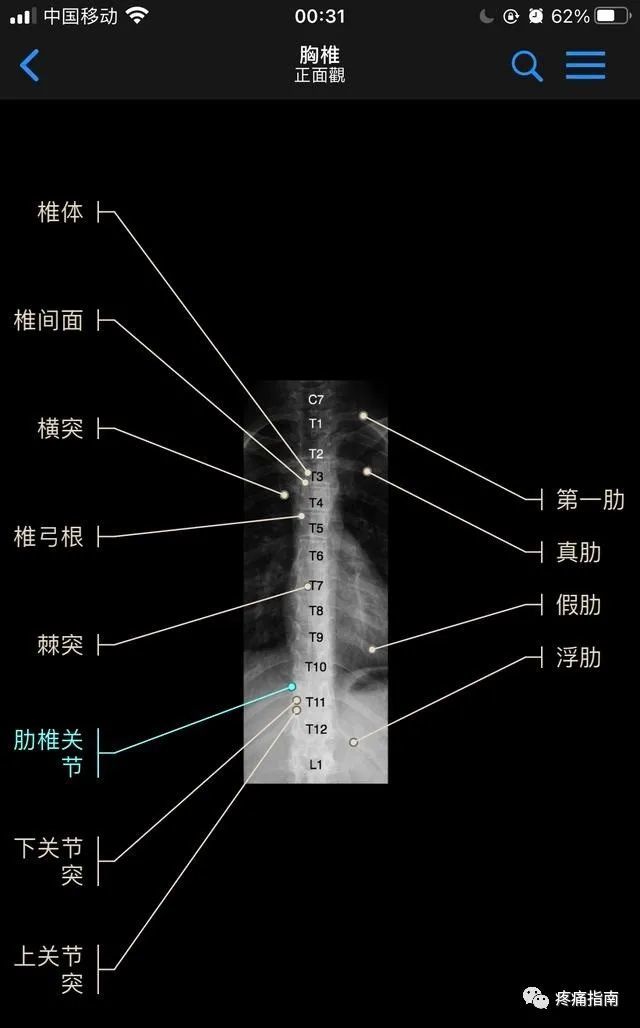 脊柱dr影像基礎