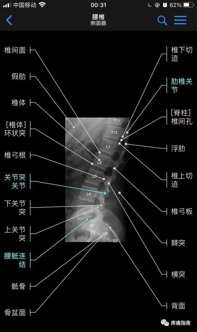 脊柱dr影像基礎