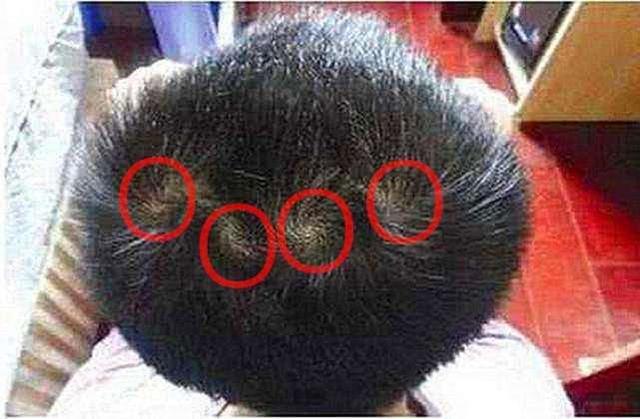 老一辈常喜欢查看孩子头上的"头旋",来预测孩子未来的好坏.