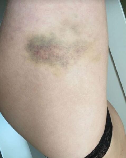 求爱不遂恼羞成怒女友晒出格林伍德家暴铁证曼联表态个人赞助商表态