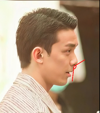 凸嘴猴化芒果脸这5位男星下颌面缺陷多却有挡不住的帅气