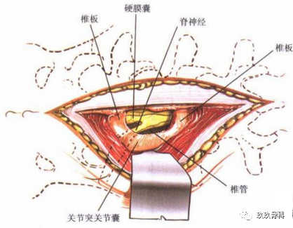 注意覆蓋硬膜表面的靜脈.