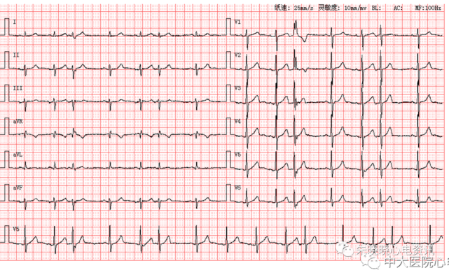 每日读图|第1639期 右位心