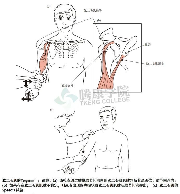 冈上肌腱撞击试验hawkins–kennedy 冈上肌撞击试验该检查是将冈上