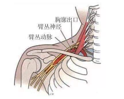 頸椎骨質增生,胸廓出口狹窄,頸椎橫突過長,肋骨骨折,肱骨頭脫位,長期