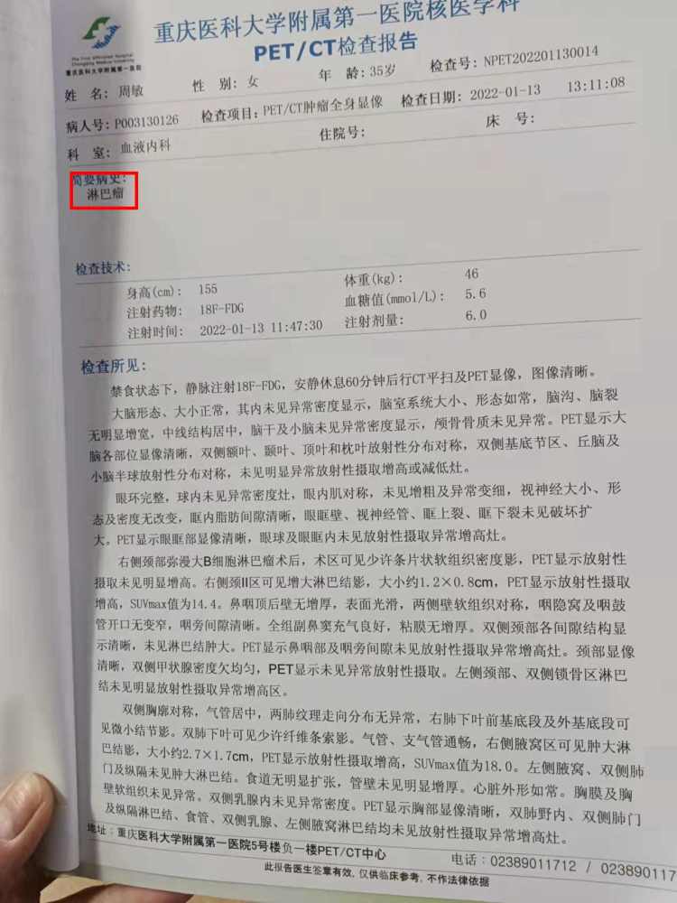年仅35岁妻子竟身患淋巴瘤,孩子尚未成年,请求大家给我妻子一个活下去