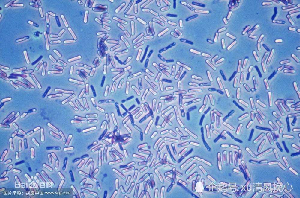 牛奶含肉毒杆菌可致白血病提醒3种牛奶少给孩子喝