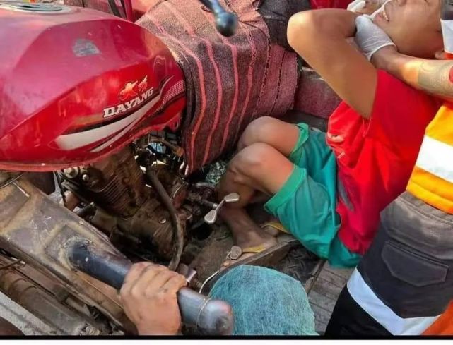 缅甸一名穿"笼基"的男子出意外,两条腿被拧成麻花