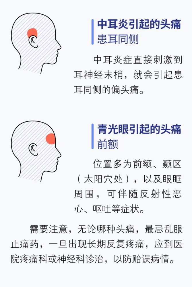 头疼是什么病的前兆图片