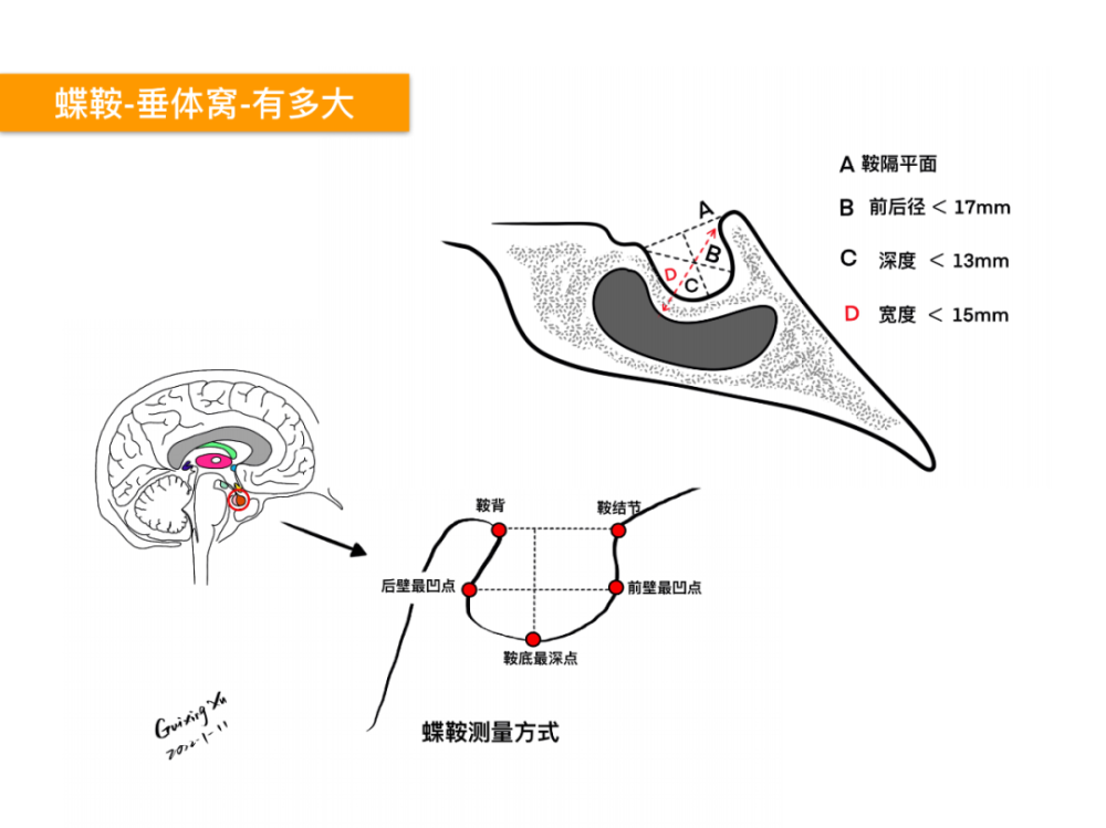 此篇主要讲解鞍区的重要性,鞍区的精细解剖,鼻腔骨性结构,蝶鞍-垂体窝