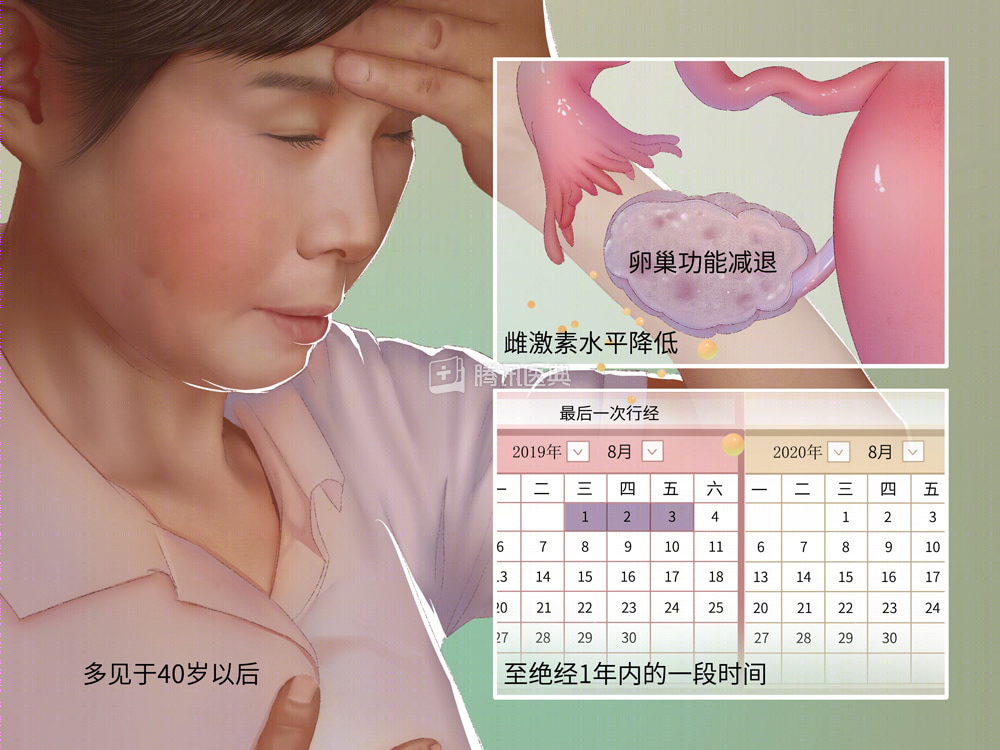 女人超过这个年龄还没绝经一定要早点去医院检查