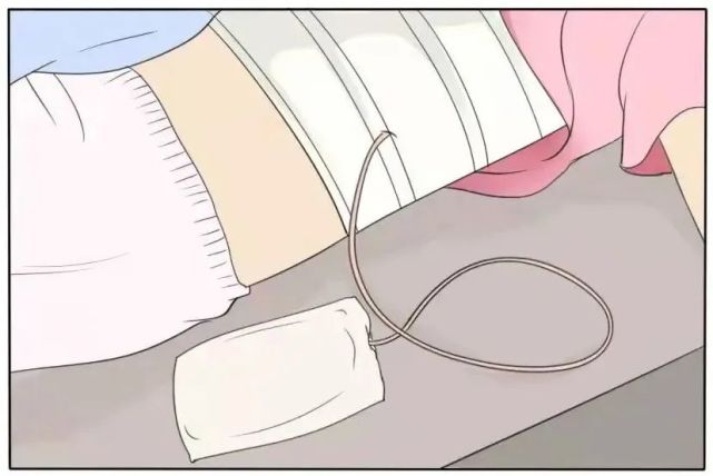 乳腺癌手术后,身侧两个"小手雷"什么时候可以摘?|乳腺癌|引流管|手术|