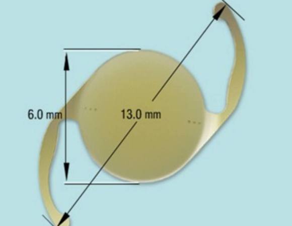 为什么白内障手术价格不等人工晶体如何选