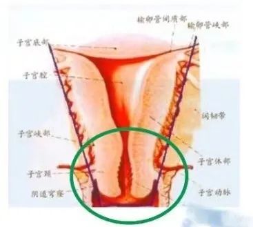 王長河教授子宮內膜癌手術治療的困惑與思考